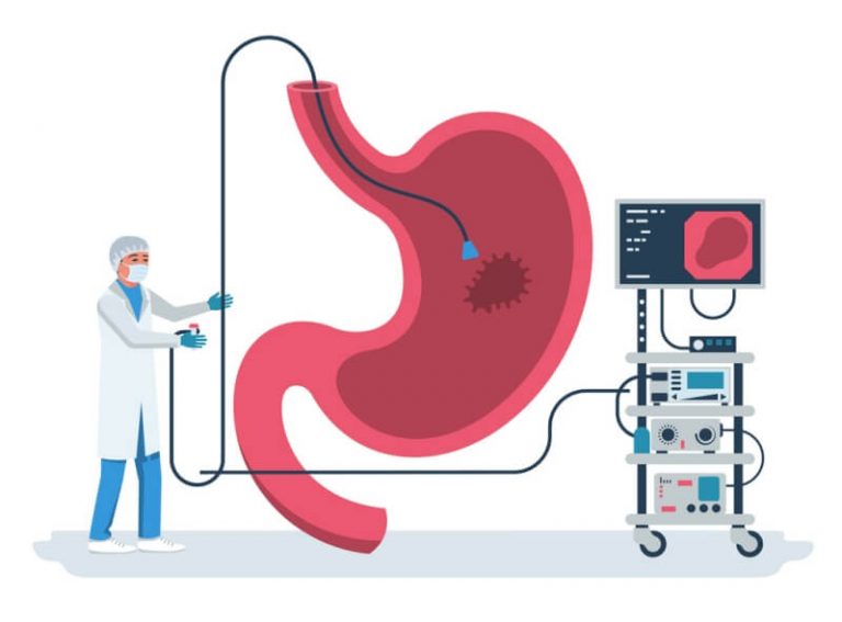 Endoscopia Digestiva Alta Gastrocentro